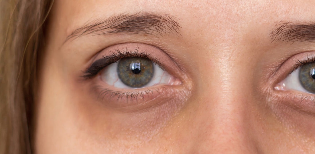 Close-up of a person's eyes with a focus on the left eye.
