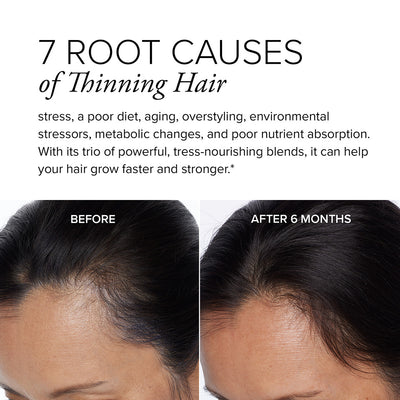 A before and after image showing a woman's hair growth results after 6 months of taking hair regrowth supplement Hair Regeneres ADVANCED