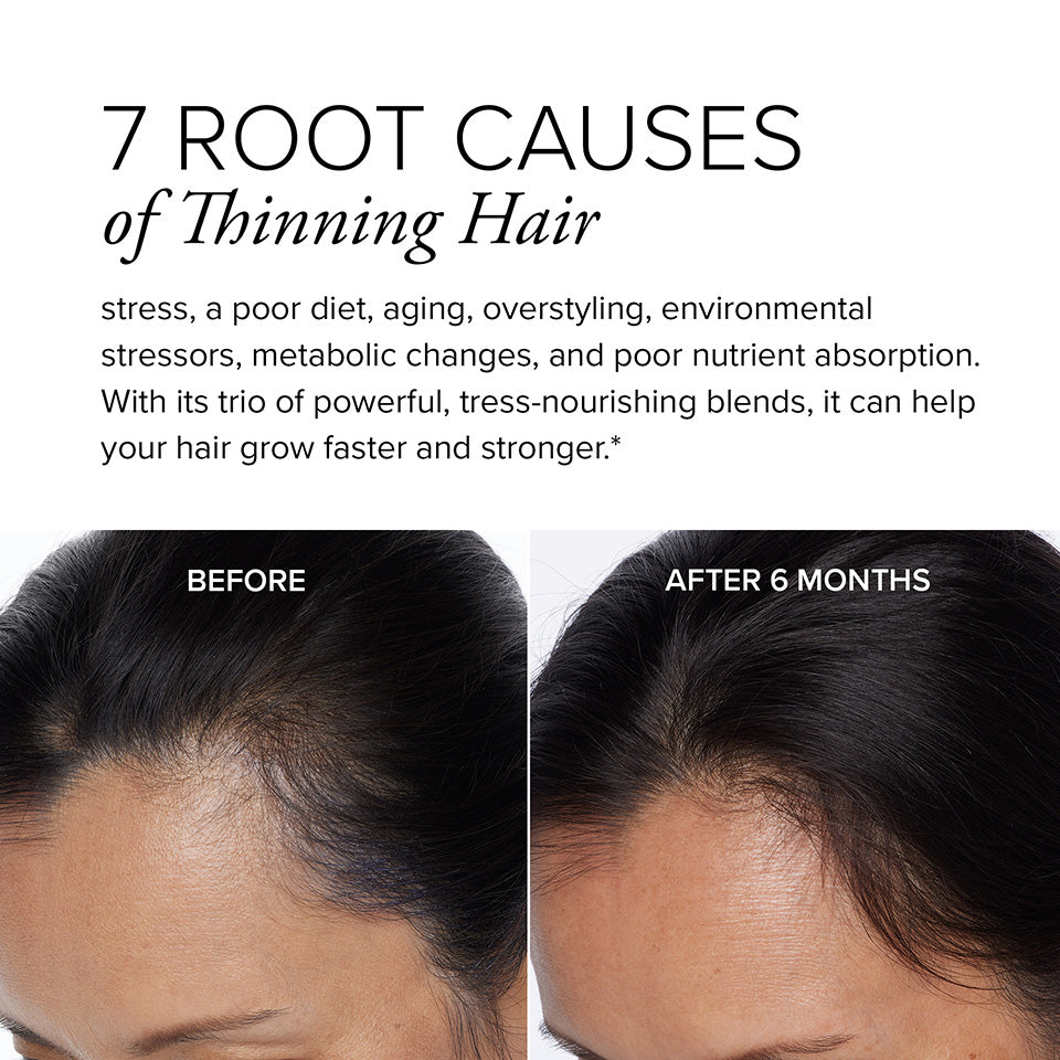 A before and after image showing a woman's hair growth results after 6 months of taking hair regrowth supplement Hair Regeneres ADVANCED