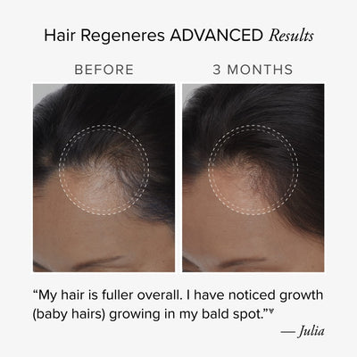 Before and after comparison of 3-months use of Hair Regeneres ADVANCED showing fuller hair and visible growth plus a testimonial from Julia.