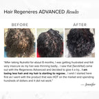 Before and after photos of a customer named Jennifer showing significant hair regrowth and reduced thinning on the top of her scalp after switching to SeroVital Hair Regeneres Advanced from Nutrafol.