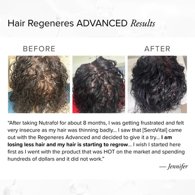 Before and after photos of a customer named Jennifer showing significant hair regrowth and reduced thinning on the top of her scalp after switching to SeroVital Hair Regeneres Advanced from Nutrafol.